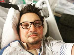 面部自拍-“鹰眼”扮演者晒出ICU自拍：躺病床上吸氧 面部憔悴淤血明显