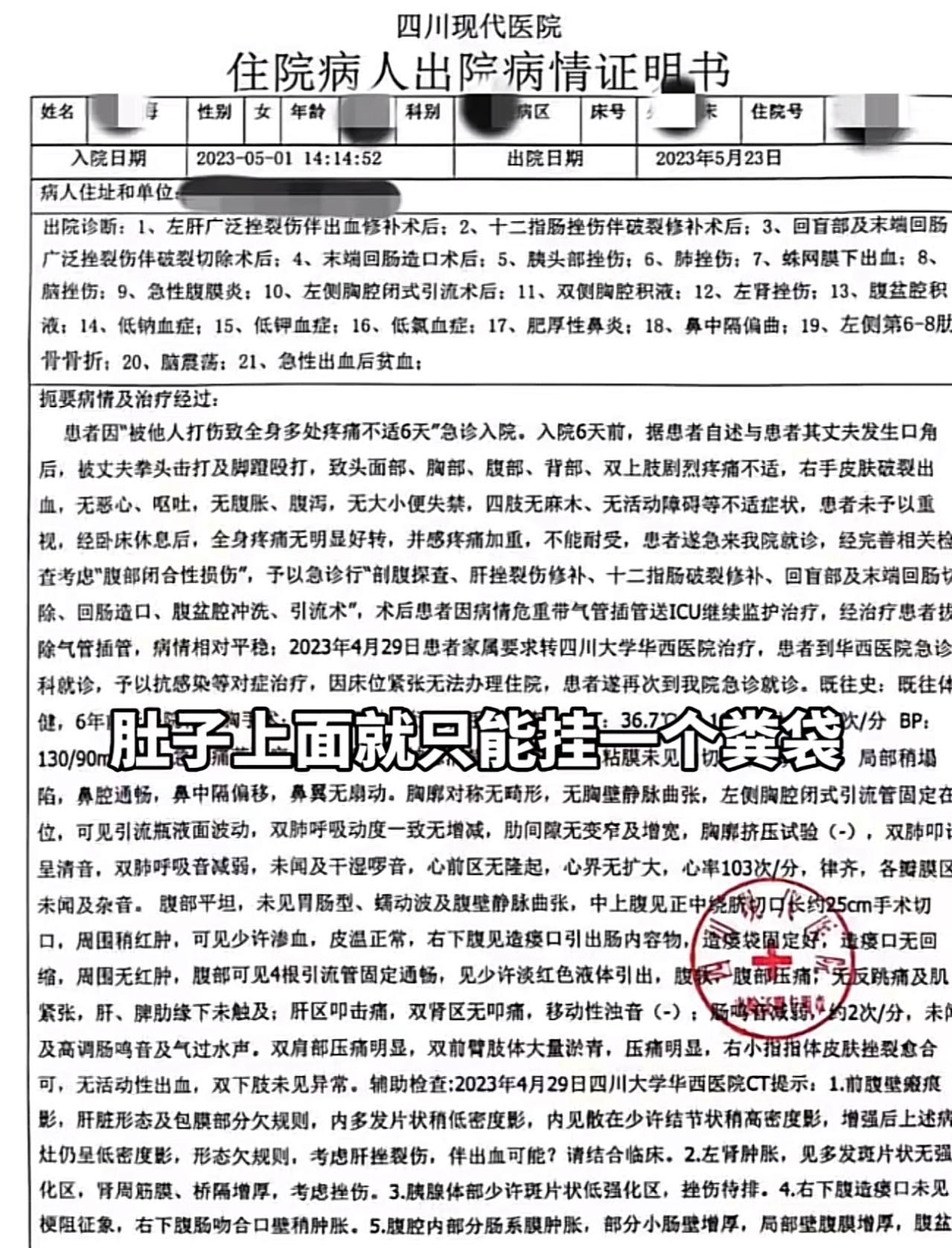 成都美女小谢被丈夫打断肠子,需长期挂粪袋