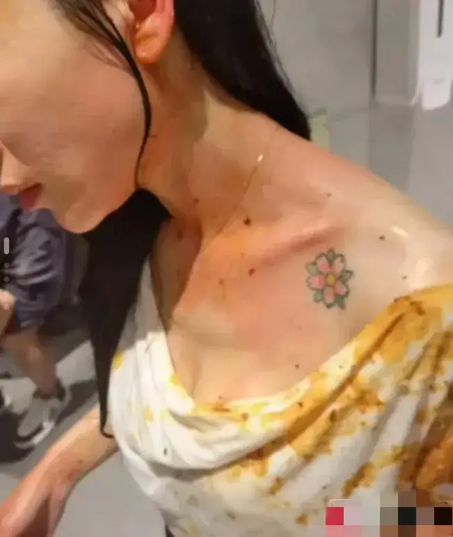 成都美女小谢被丈夫打断肠子,需长期挂粪袋