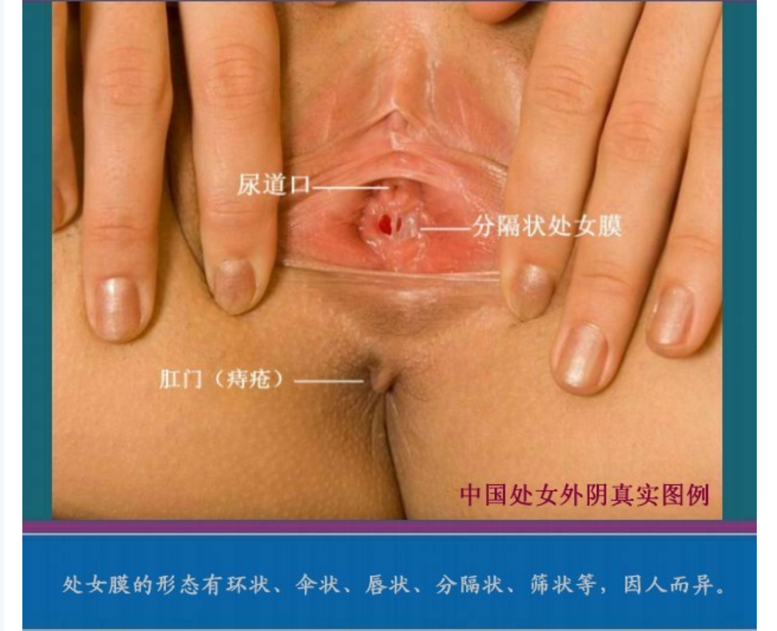 [精品]女人处女膜高清图片鉴定及破处后照片区别,男人必备