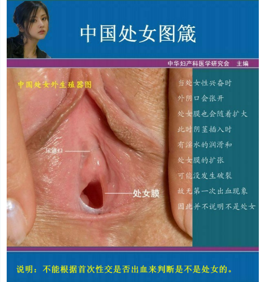 [精品]女人处女膜高清图片鉴定及破处后照片区别,男人必备